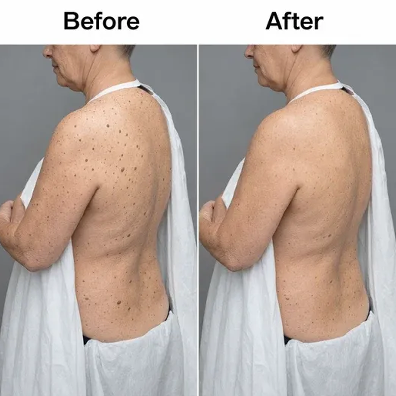 Acezozla Glycolic Body Stick