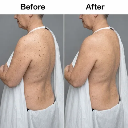 Acezozla Glycolic Body Stick